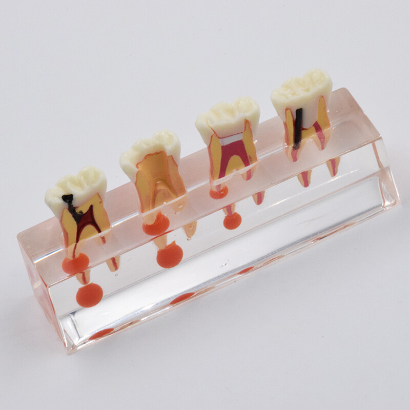 Dental Study Teaching Model Periodontal Caries Disease Teeth Dentoform Typodont