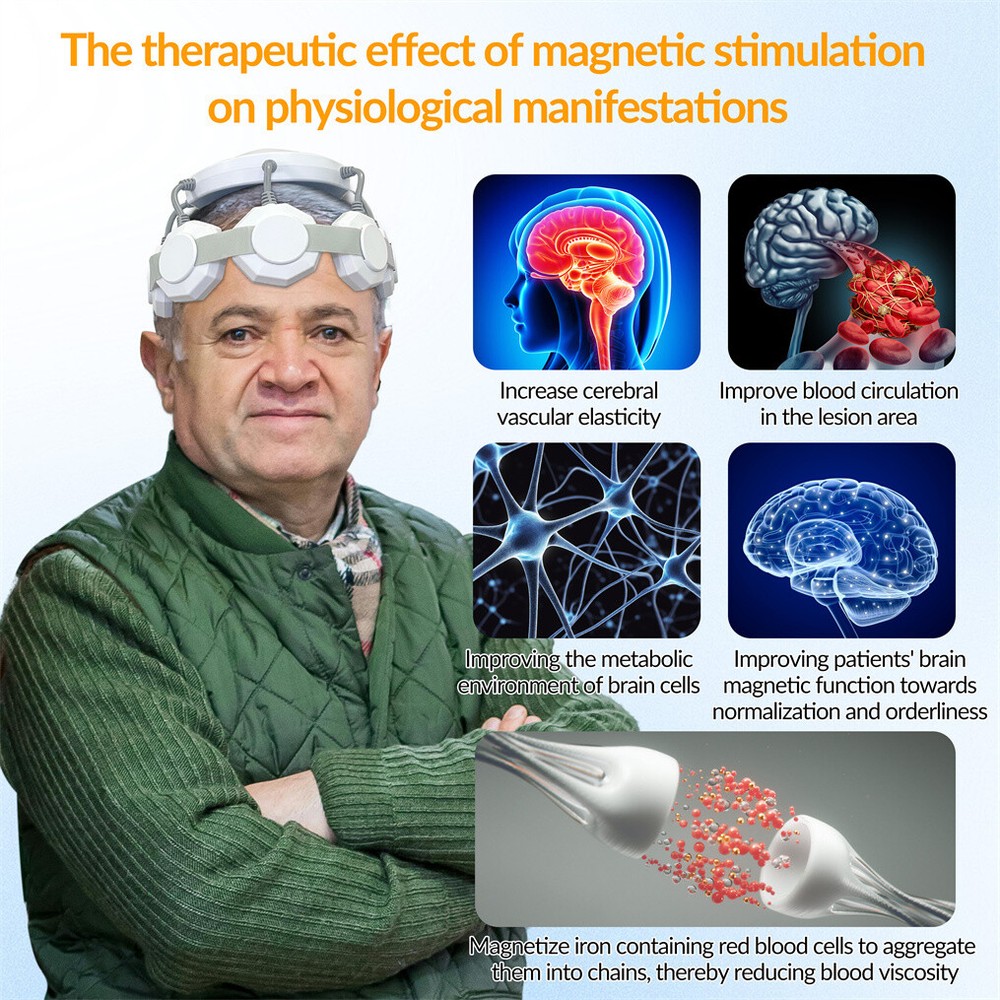 TMS Therapy Neuromodulation Device Headache Relief Relaxation Support