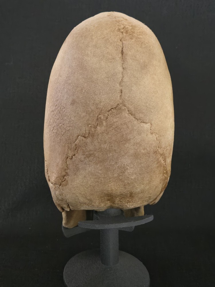 Real Human Skull - Peruvian Enlongated- Hyper Realistic Replica with stand.