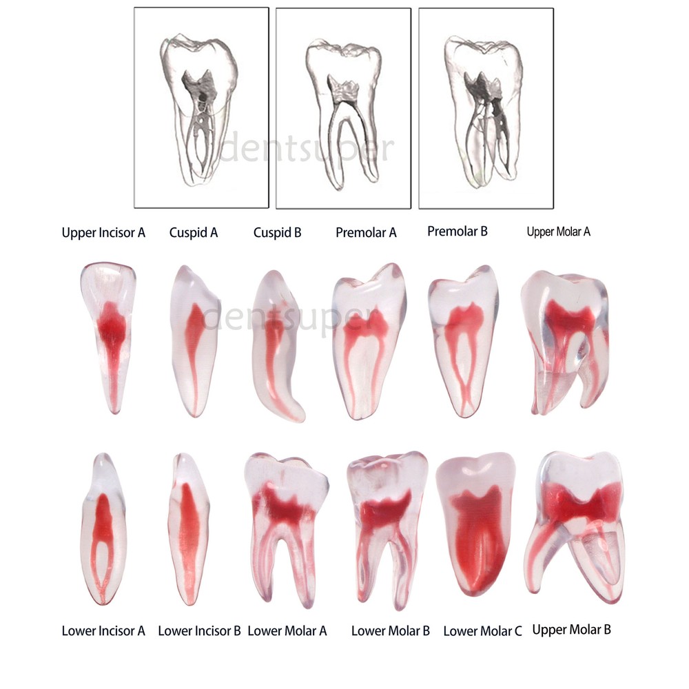 Dental Resin Study Endo Root Canal Teeth Model Practice Block RCT Pulp Cavity