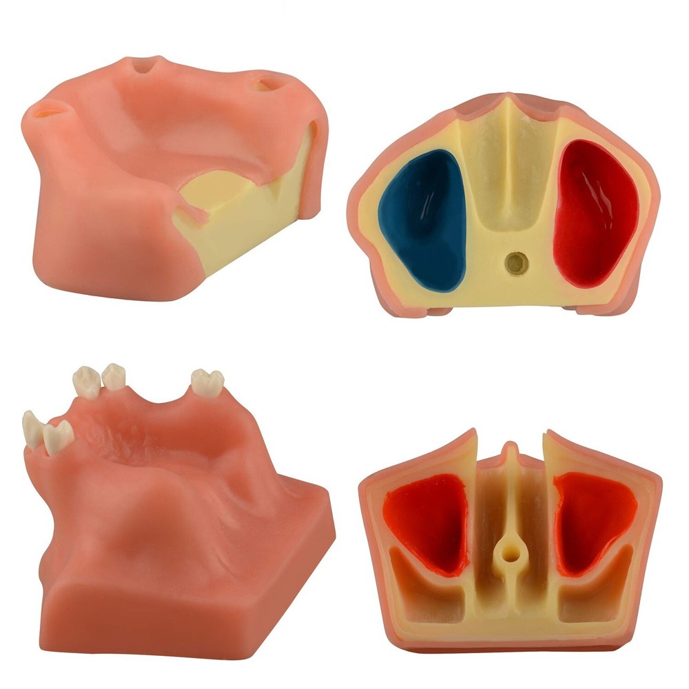 Dental Maxillary Teeth Model Sinus Lift Implant Practice Study Teach Demo Model