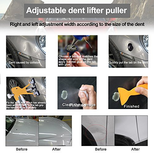 Gliston Auto Dent Puller Kit - Adjustable Golden Dent Remover Tools Paintless &