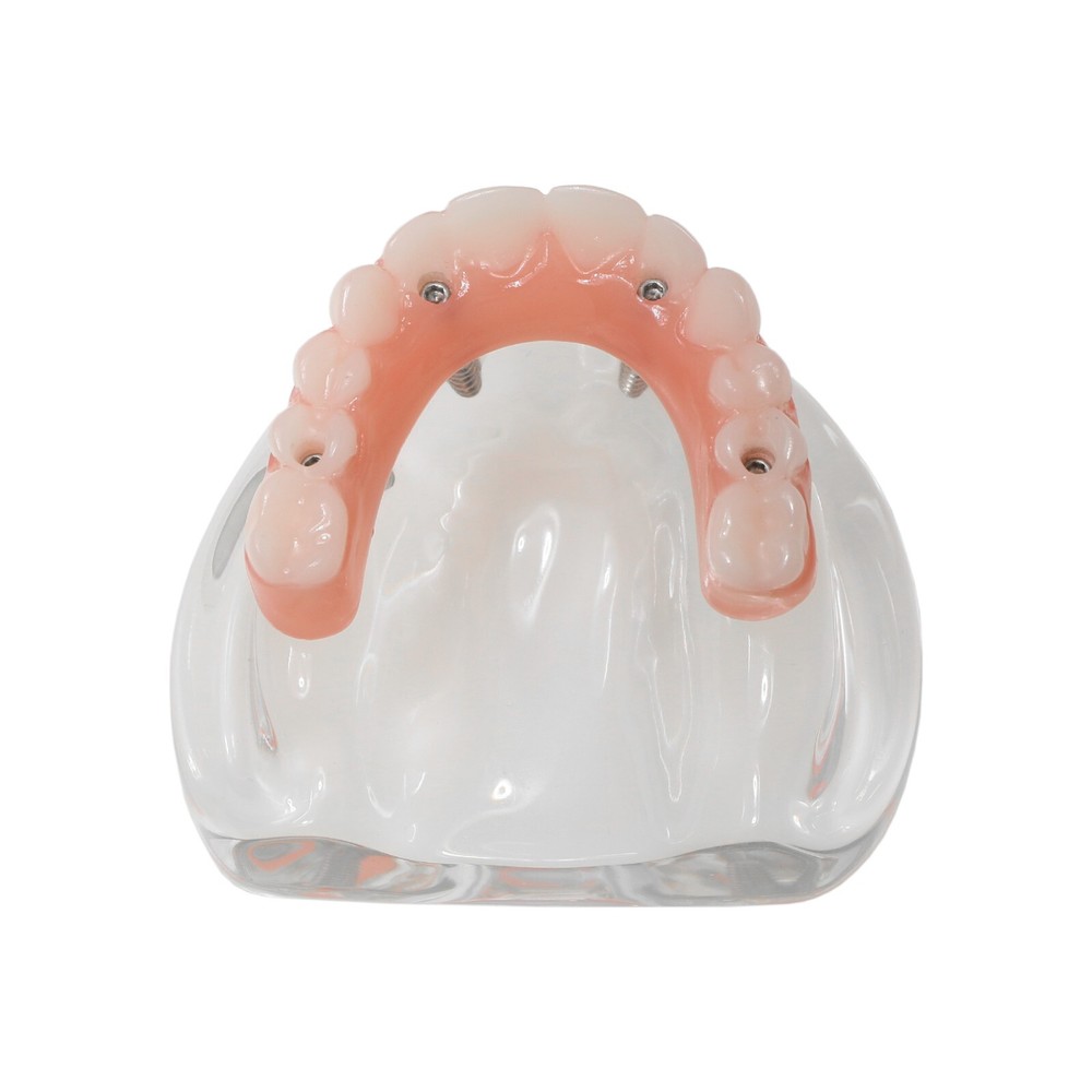 Implant Practice Demo Multiple Types Dental Teaching Teeth Model Typodont Ortho