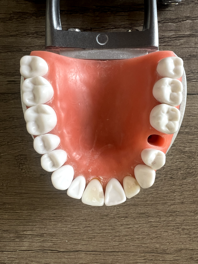 Acadental ModuPRO Restoration Typodont + Case WREB CDCA ADEX