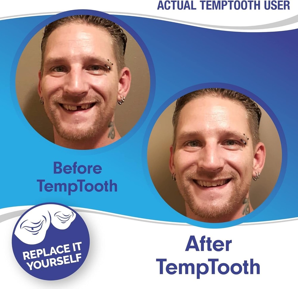 Trusted Patented Temporary Tooth Replacement Kit - Size 3cm - Color Natural -...