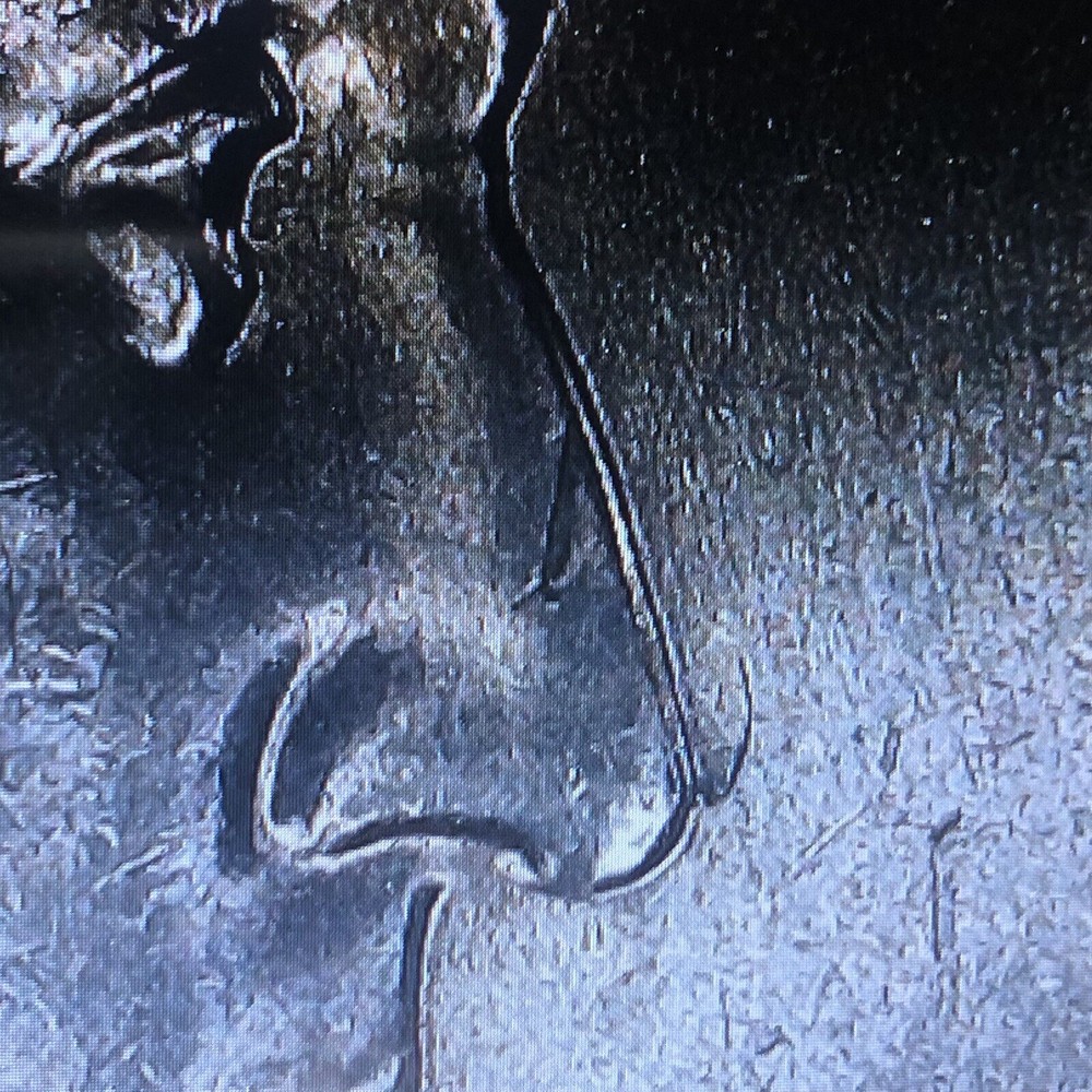 4 ERROR Edith Kanaka’Ole Quarters