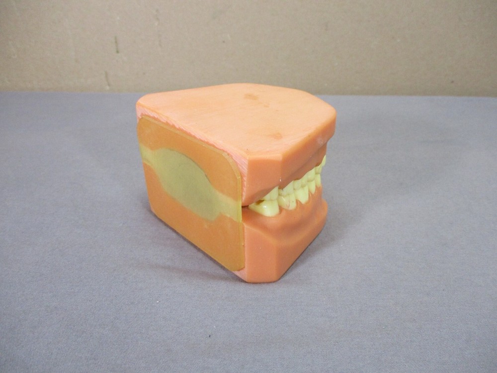 Dentist Typodont Dentoform Dental Model Teeth Overbite Tooth Display Hinged Set