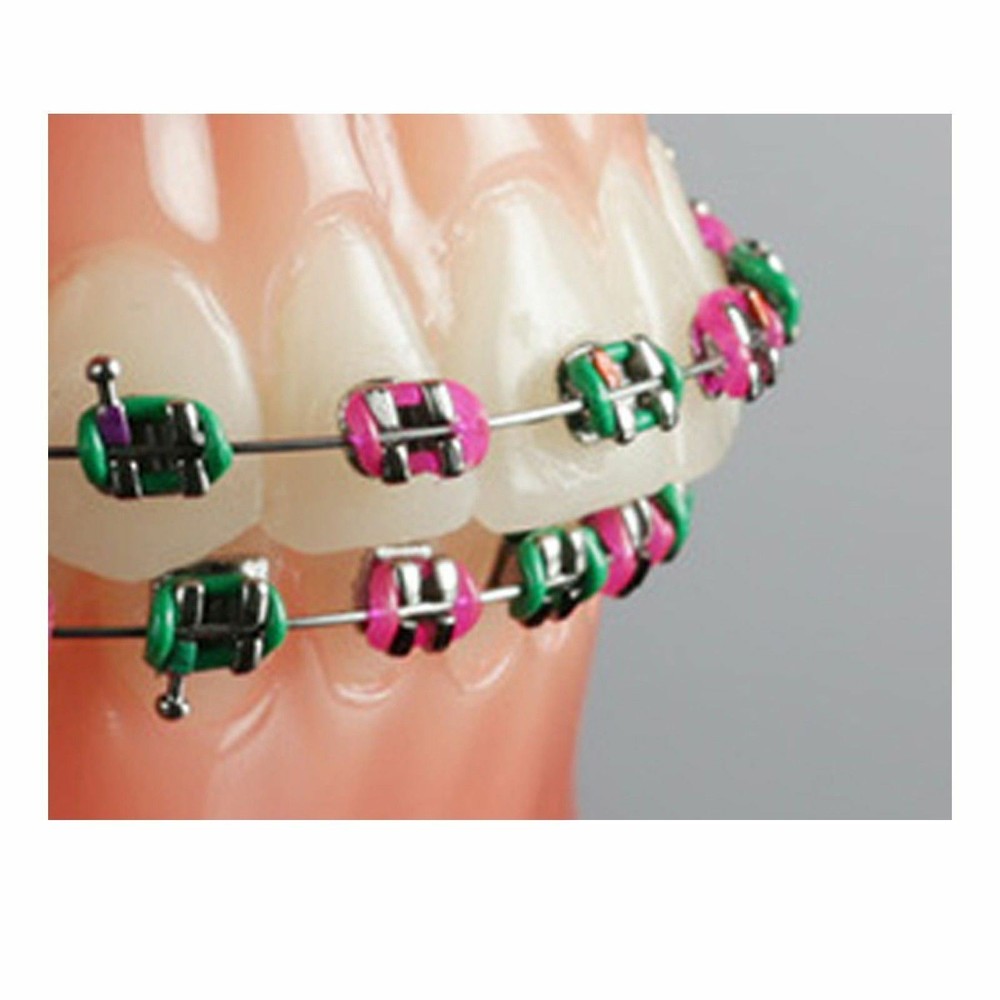 Dental Aesthetic Tooth Orthodontic Elastic Ligature Modules Assorted 5000pcs