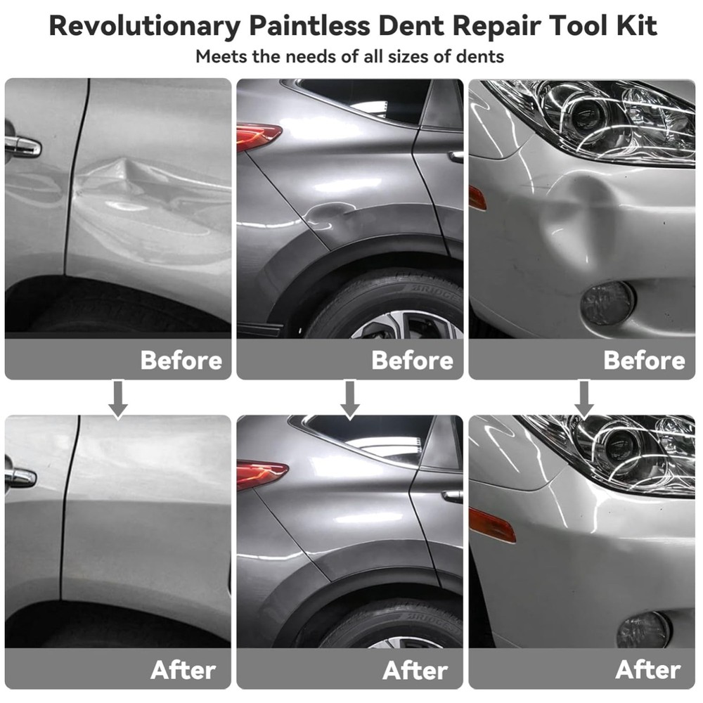 Professional Dent Removal Kit - Paint-Safe & Effective