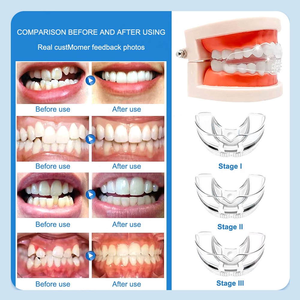 3 Stages Invisible Dental Orthodontic Teeth Corrector Braces Retainer Alignment