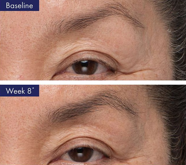 Obagi Nu-Cil™ Eyebrow Boosting Serum 0.17 fl oz