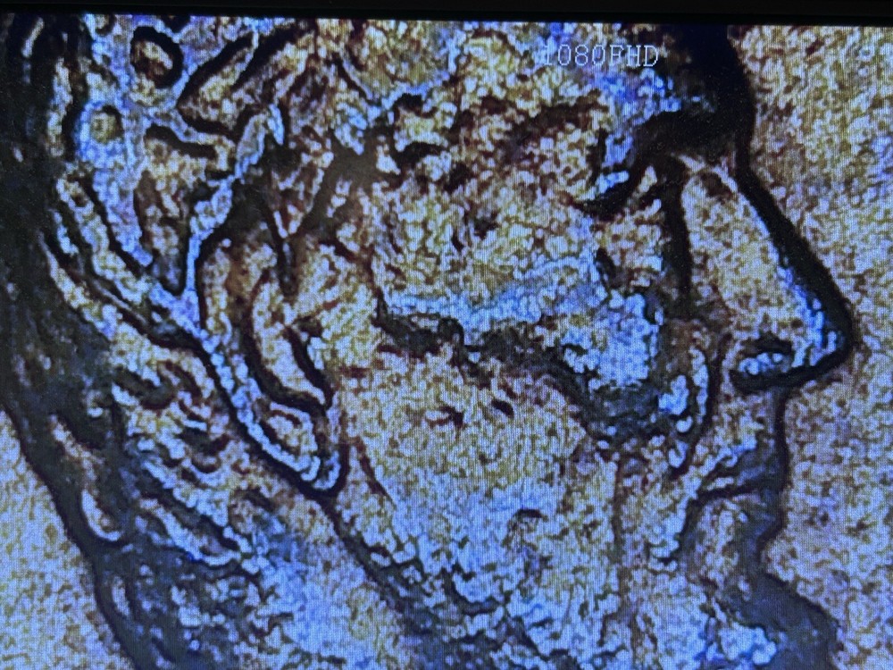 1983-P Lincoln Memorial Cent Error-collectors View