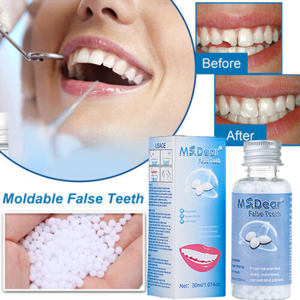 Tooth Repair Kit - Temporary Teeth Replacement Kit for Missing & Broken Teeth US