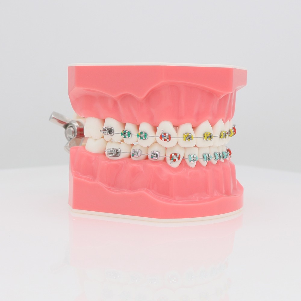 Dental Orthodontic Teeth Model Typodonts Model Demonstration Model with Brackets