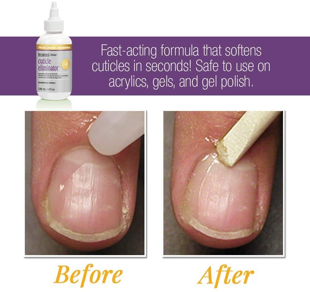 Cuticle Eliminator Remover