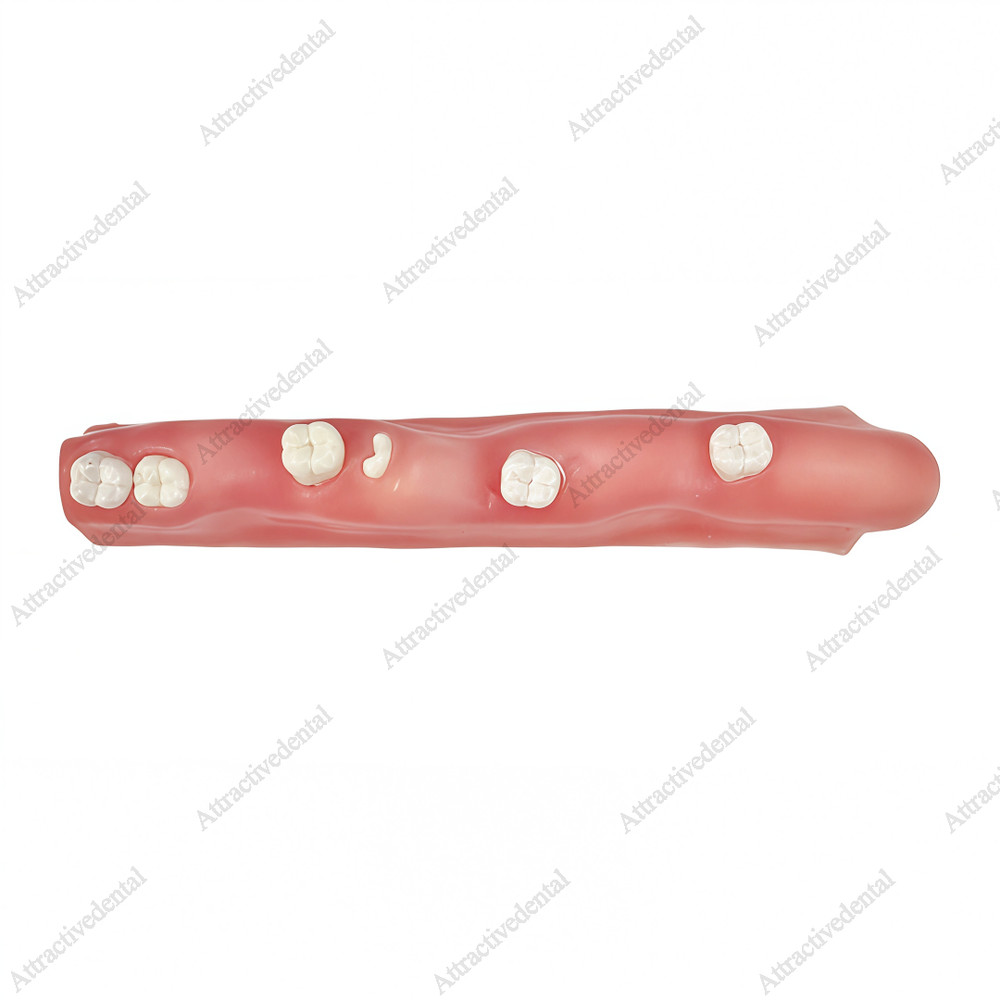 Dental Impacted Tooth Model Wisdom Unerupted Tooth Extraction Practice Training