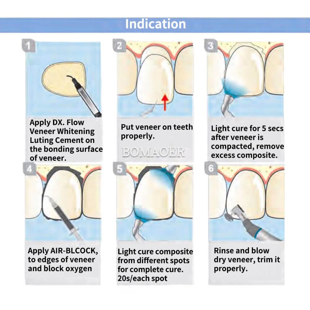Dental OA2 Light curing Flowable Composite Resin U.LINK BASE DC&LC luting cement