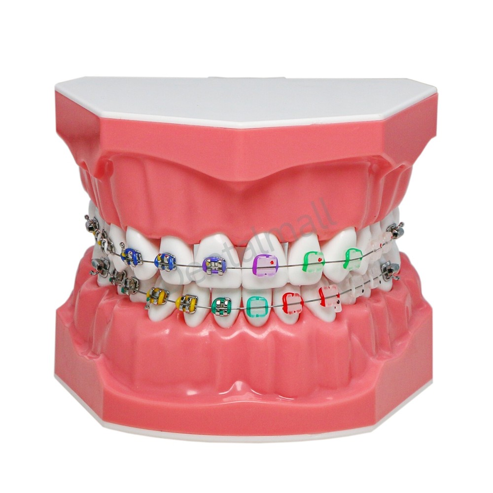 Dental 1:1 Teach Study Typodont Teeth Model Half Metal Ceramic Brackets Tubes