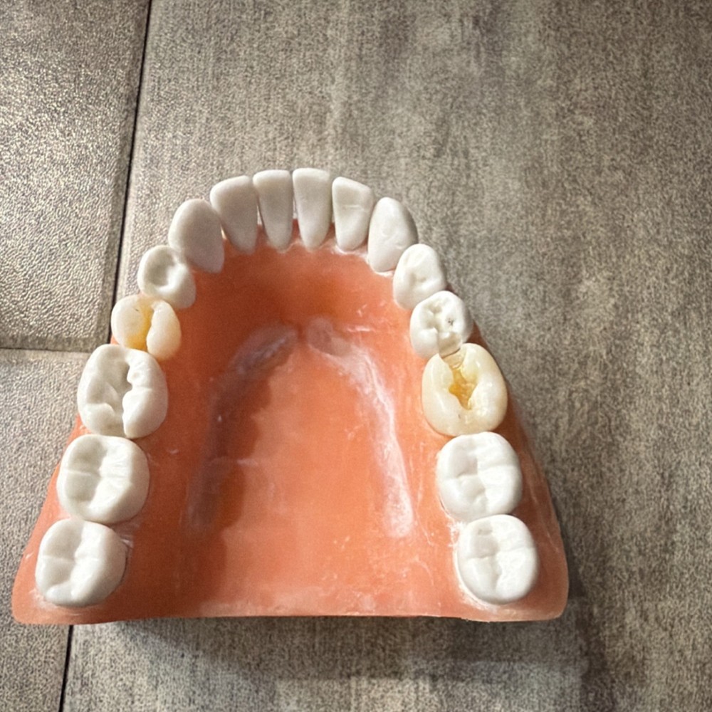 Dental Typodont Model Removable Teeth Full Set Upper/Lower Jaw for Dentistry