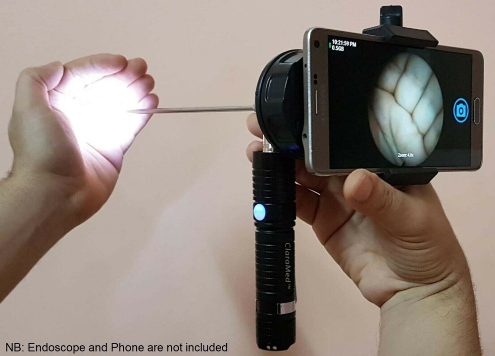 ClaraMed smartphone endoscope adapter with ACMI compatible LED light source S5