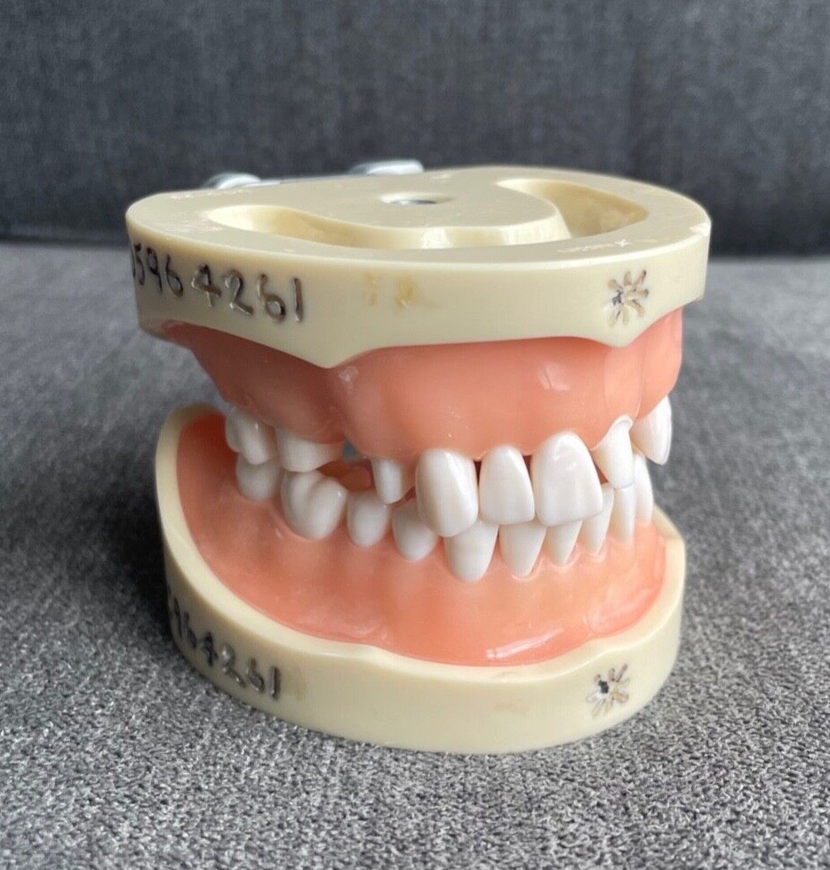 Fixed Prosthodontics Dentoform (Used in Dental School)