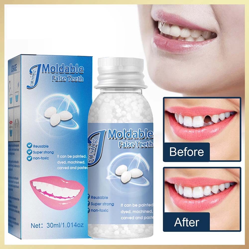 Tooth Repair Kit Temporary Teeth Replacement Beads for Missing & Broken Teeth