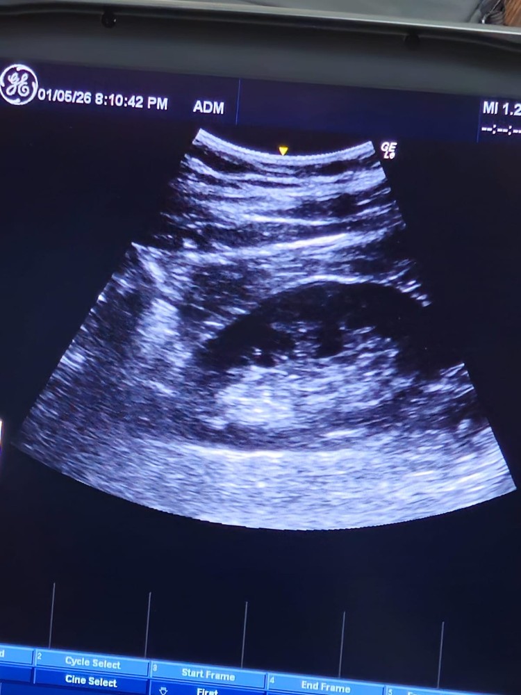 GE Convex Probe 4C-RS