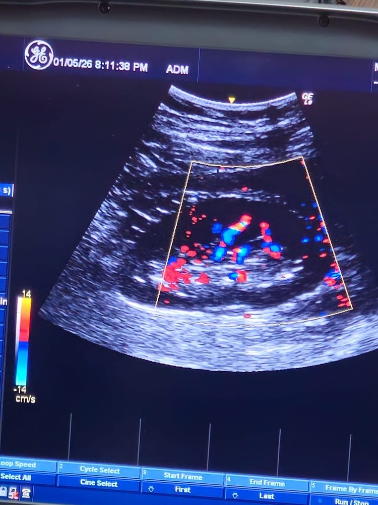 GE Convex Probe 4C-RS