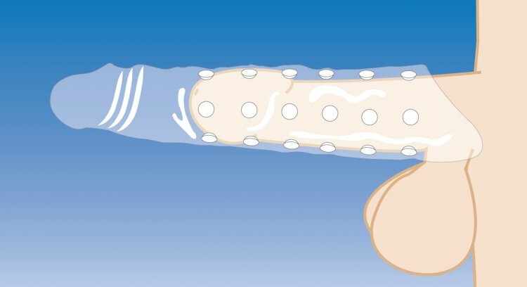 EXTREME AMPLE 11" Realistic Male Penis Extender  Add 3" W/Solid Tip & Ball Strap