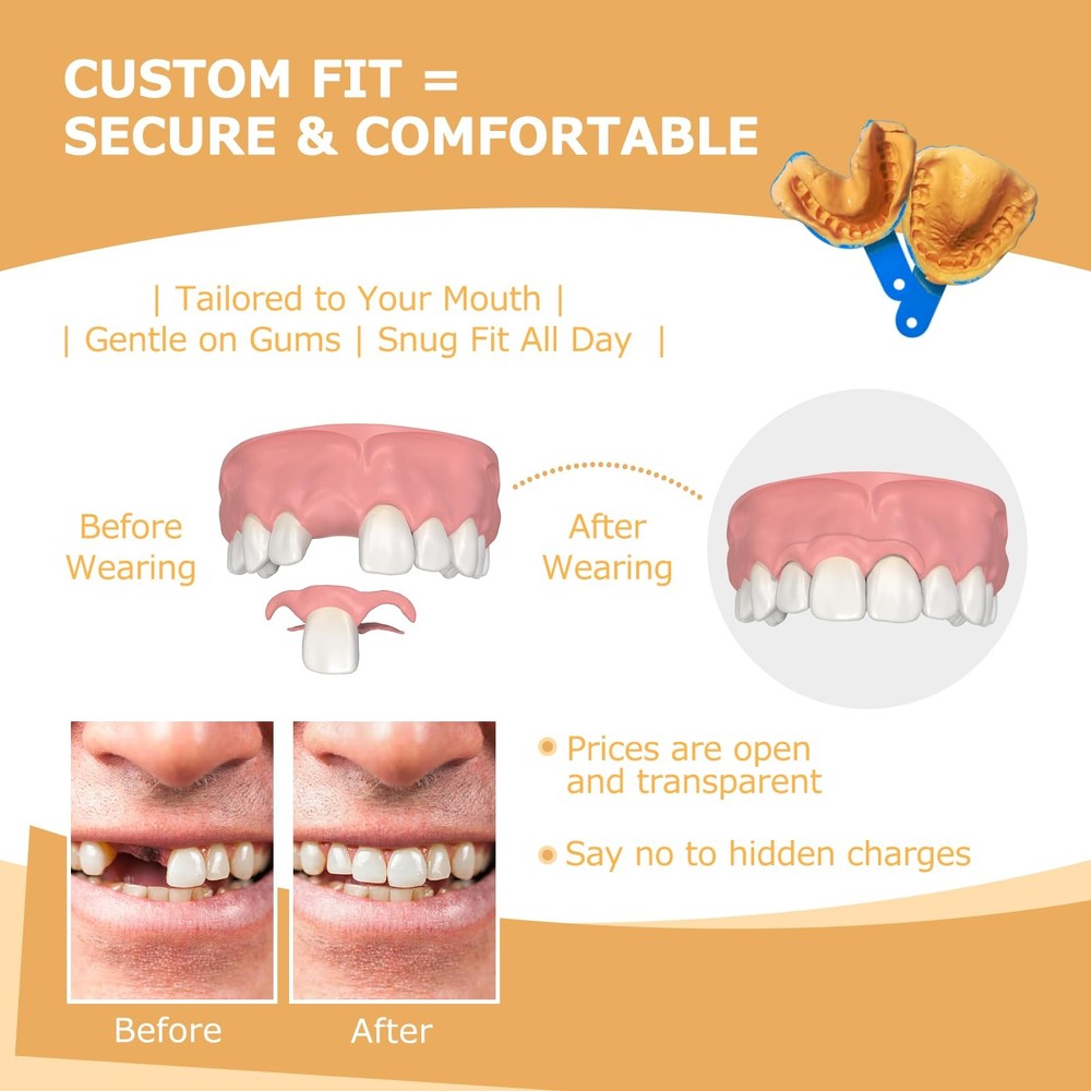 Partial Dentures - for Missing Teeth & Gaps - 1 Tooth, White
