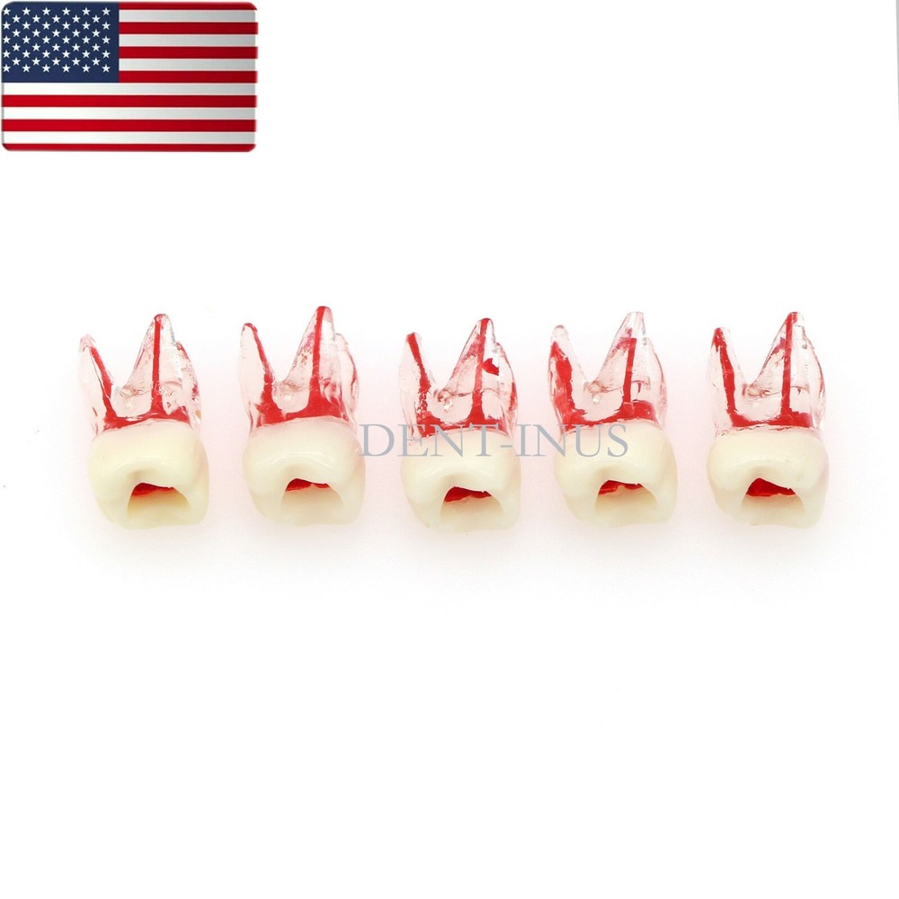 US Dental Endo Molar Root Canal Study Practice Block Pulp Cavity Model RCT/MTA