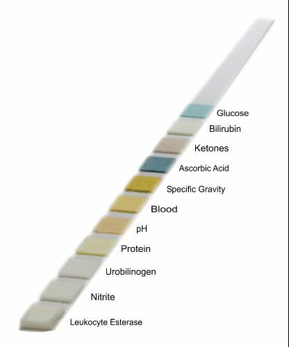 Urine Test Strips for Urinalysis 11 Parameters. 150 Cnt Urinalysis Test Strips