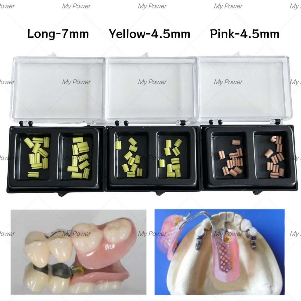 Dental Clips Bolt Inserts Precision Overdenture Attachment Yellow/Pink Embed L/S