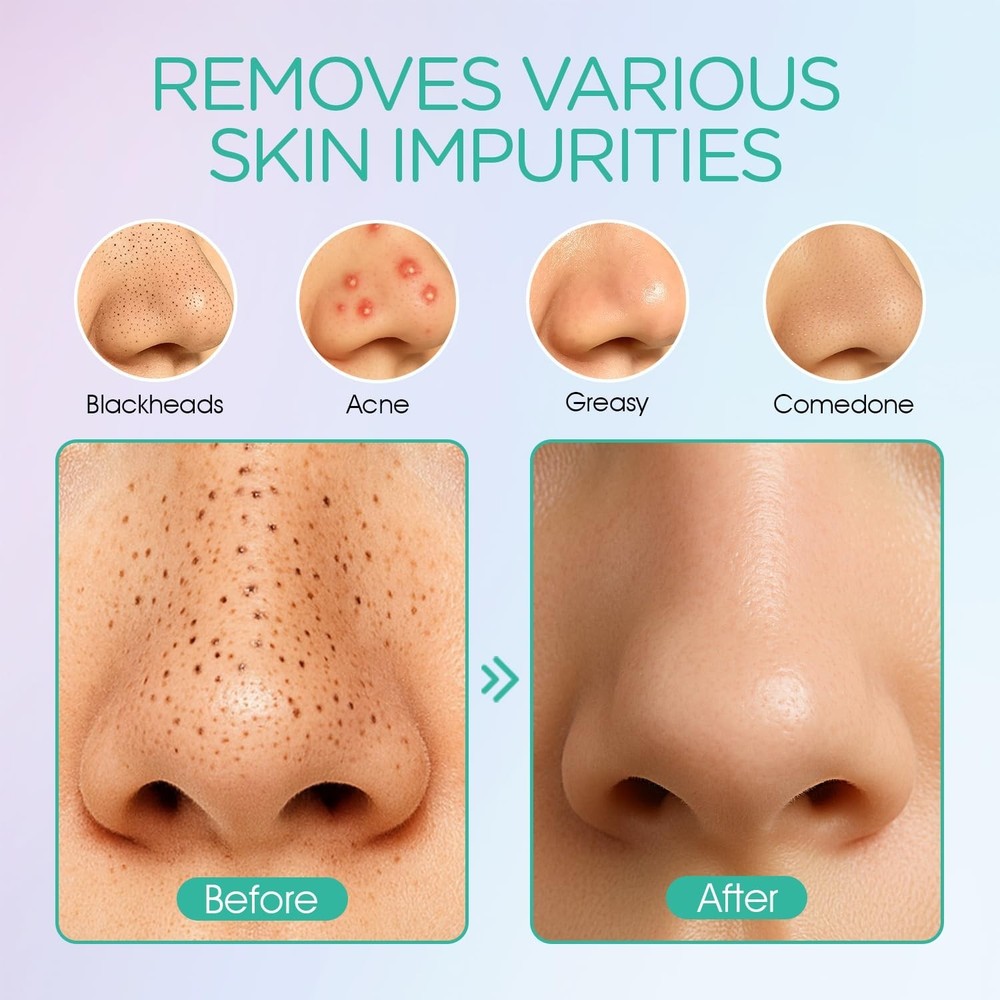 Professional Blackhead Extractor - Facial Cleansing Tool
