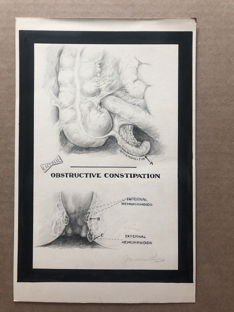 Vintage LACTOSIL Pencil Drawing Signed CONSTIPATION Appendicitis Hemorrhoids