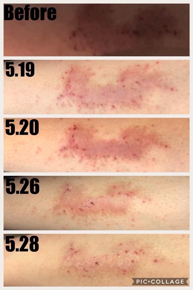 MAGIC V Wound Healing Cream 8oz.