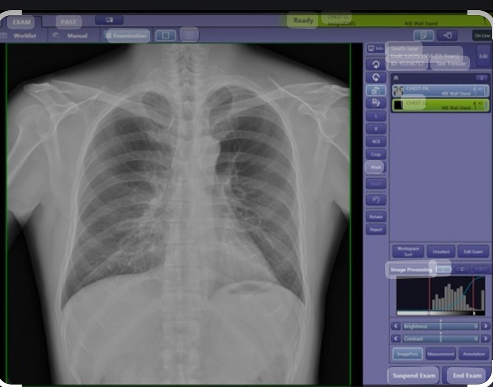 MobileArt Evolution MX7 SHIMADZU MobileDaRt Evolution mobile xray