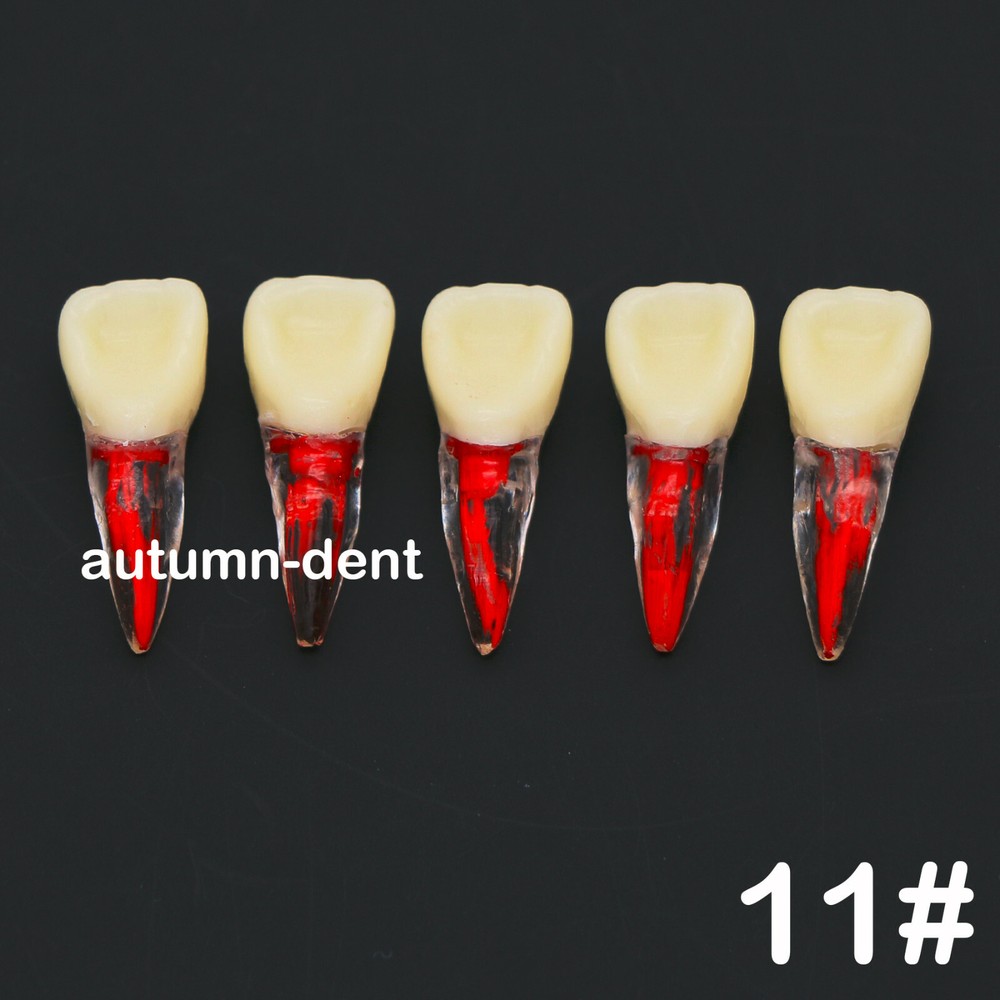 5Pcs Dental Endodontic Root Canal RCT Practice Pulp Cavity Endo Teeth Tooth 11#