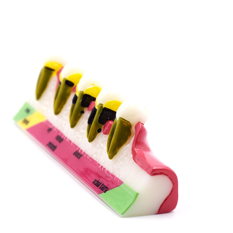 Dental High Quality Assort Dentoform Pathological Study Periodontal Model Teeth