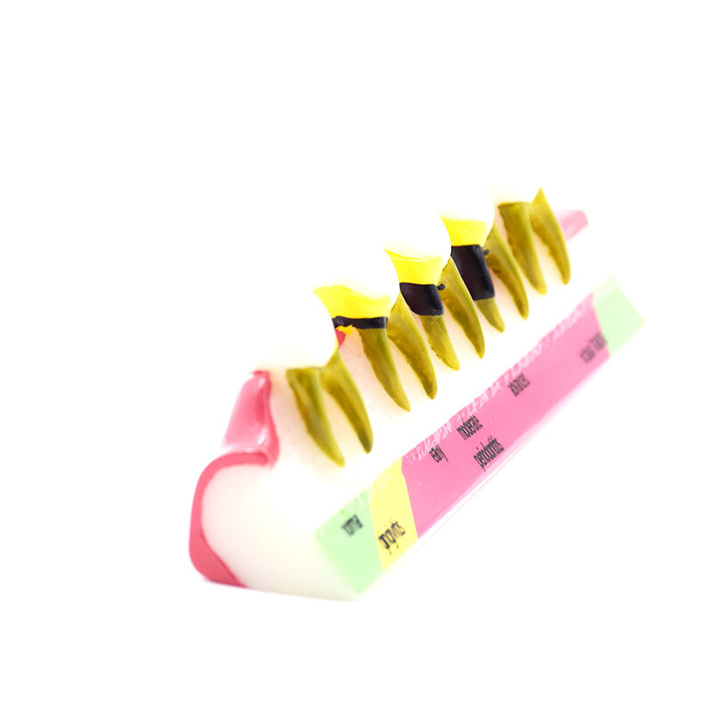 Dental High Quality Assort Dentoform Pathological Study Periodontal Model Teeth