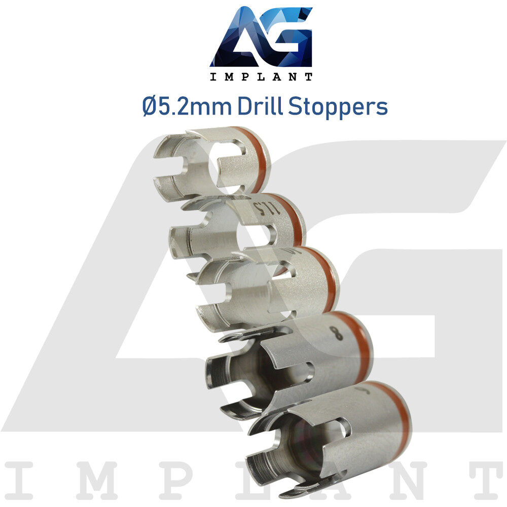 5 Drill Stoppers Ø5.2mm External Irrigation Tools Dental