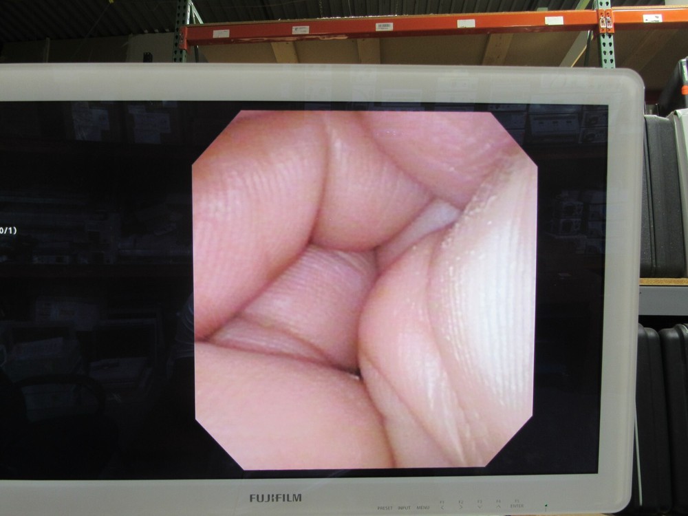 URF-V Video Ureteroscope Endoscope DISCOUNTED!!