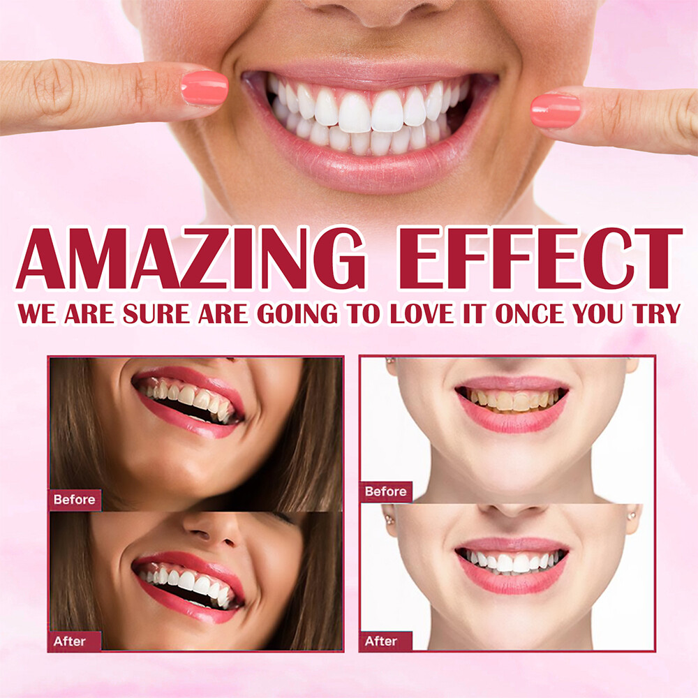 3Pcs SP-4 Probiotic Toothpaste, Sp-4 Toothpaste Whitening ,Remove yellow teeth