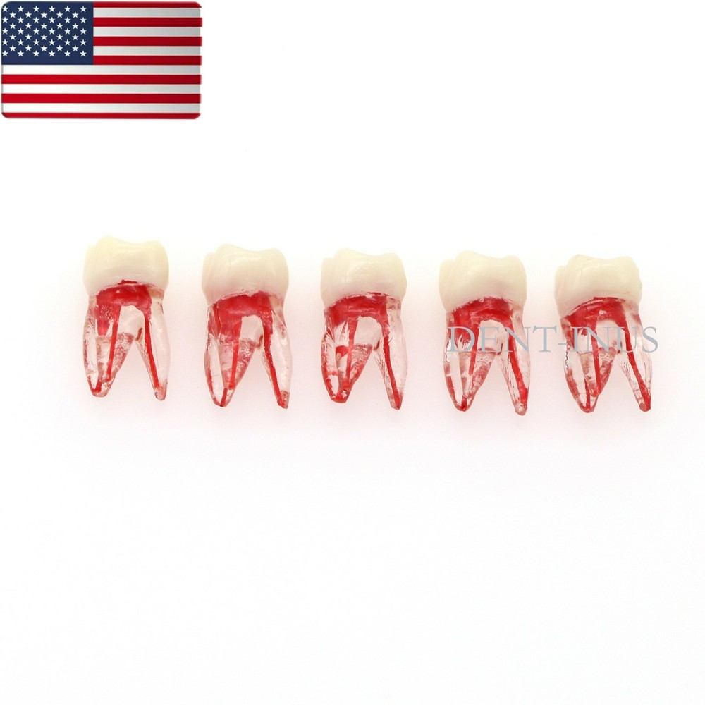 US Dental Endo Molar Root Canal Study Practice Block Pulp Cavity Model RCT/MTA