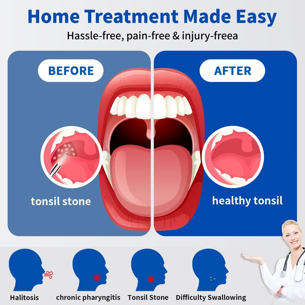 Tonsil Stone Remover with Camera，Tonsil Stone Removal Tool with LED Light，Ton...