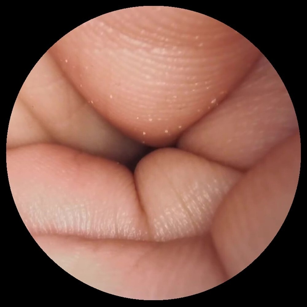 Medical LED 100W Endoscope Endoscopy Microscope Cold Light Source Adjustable