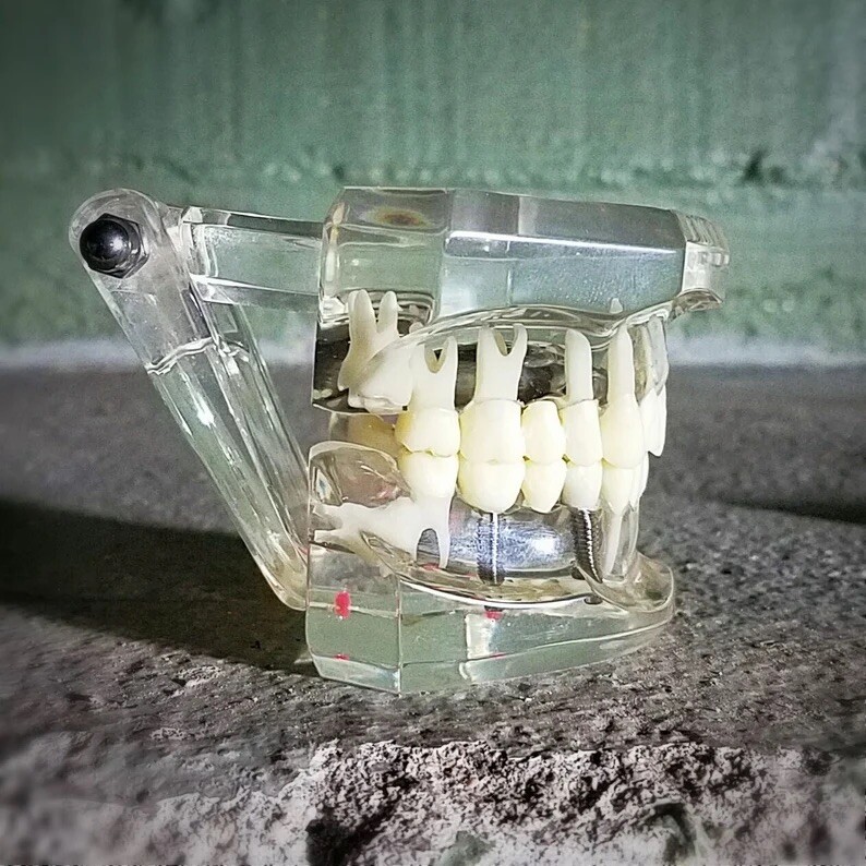 Dental Consultation Model