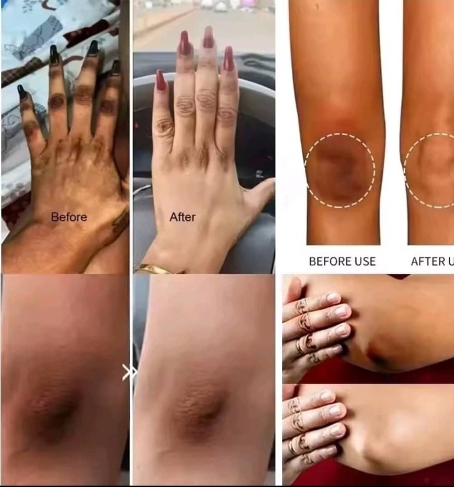 Whitening Cream Private Parts