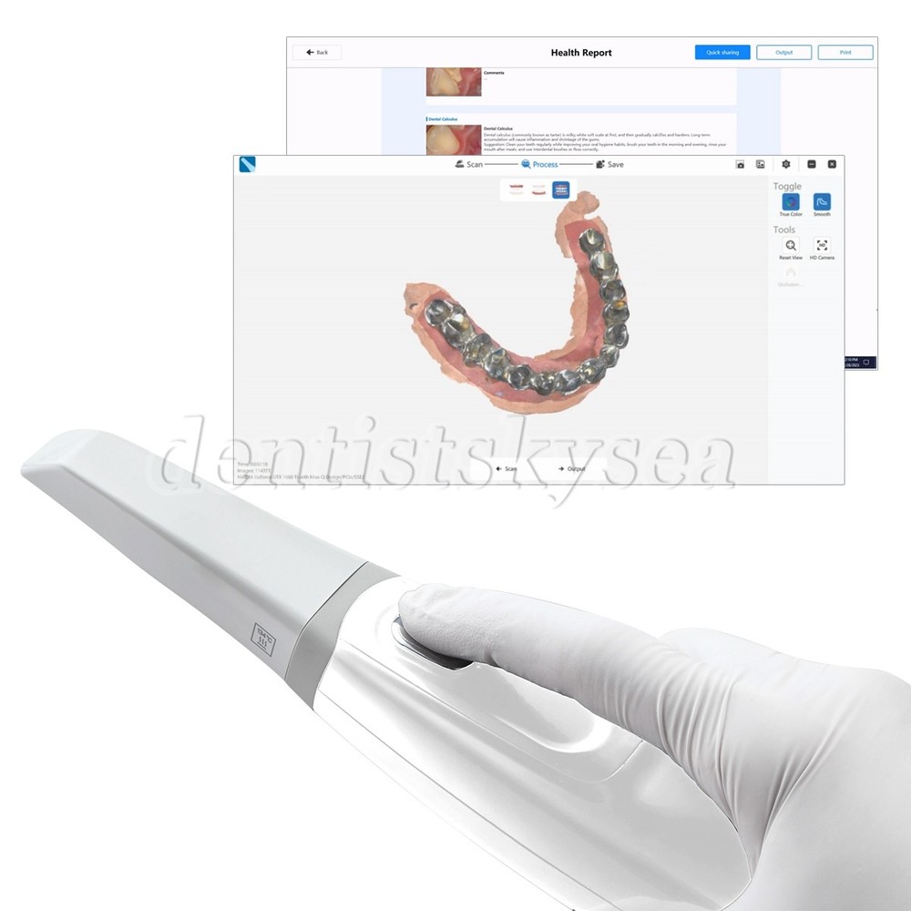 Intraoral Scanner Digital Impression Intraoral 3D Scanner & Software AI H