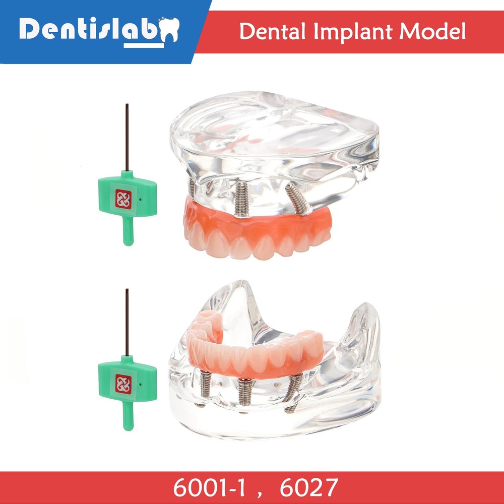 Dental Implant Model Dental Simulator Teeth Model Upper & Lower Teaching Model